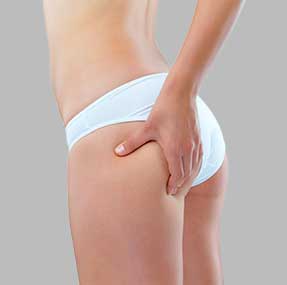 Cellution® : La Solution Révolutionnaire pour Combattre la Cellulite